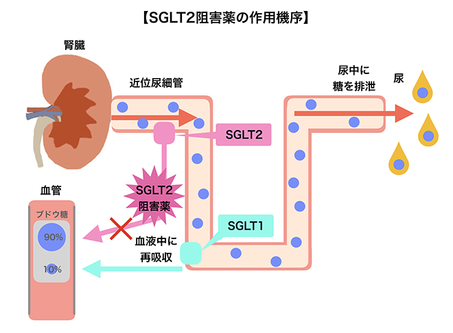 【糖尿病専門医が解説】SGLT2阻害薬の効果と副作用について
