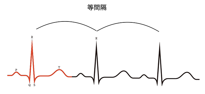【循環器専門医が解説】日本でもApple Watchで心電図計測が可能に。その意義と精度は？